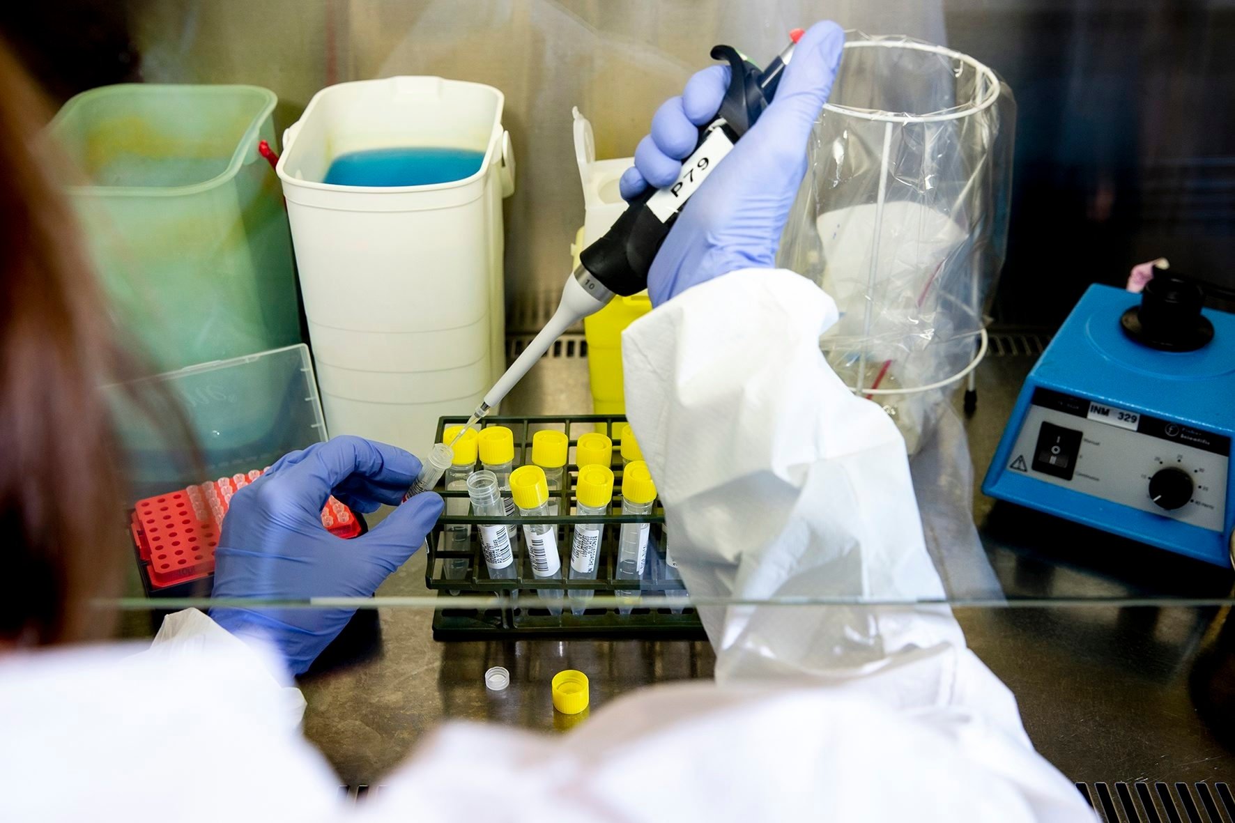Plusieurs centaines de prélèvements sont analysés chaque jour au laboratoire chaux-de-fonnier d'Admed.