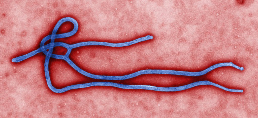 Voilà Ebola. Le virus qui provoque des fièvres hémorragiques et qui sévit actuellement en Guinée, au Liberia et en Sierra Leone.