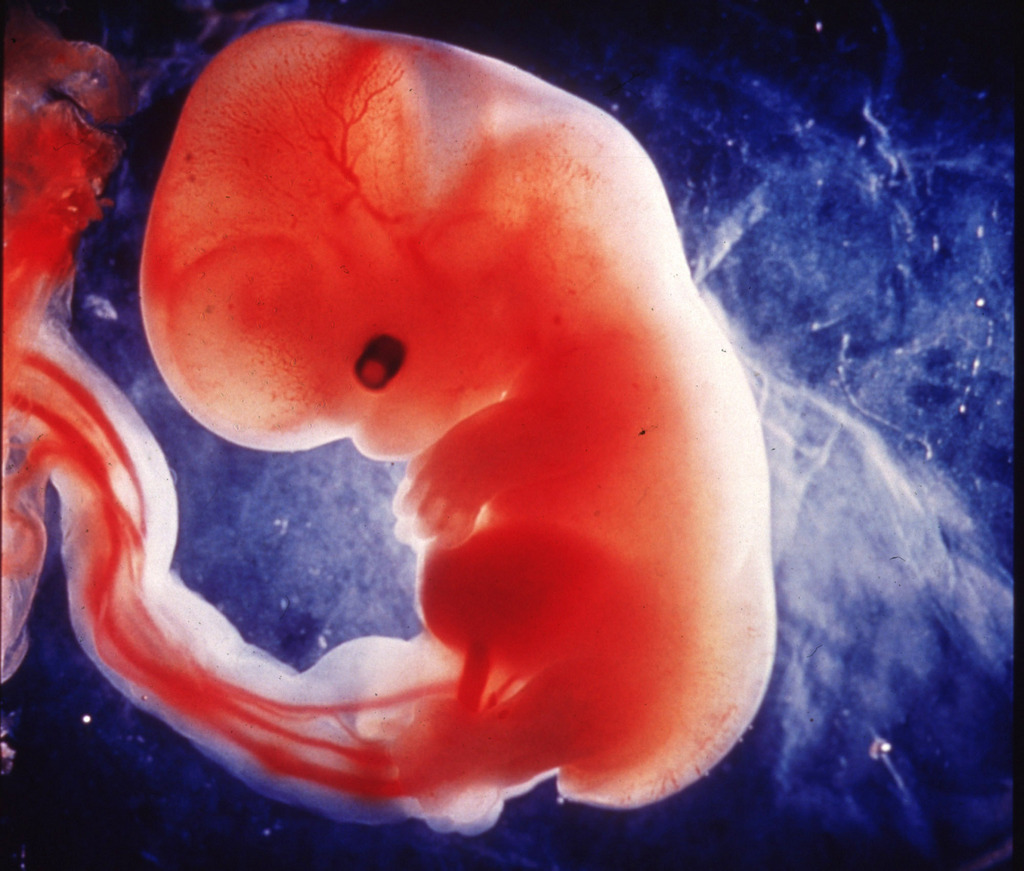 Les avortements de foetus féminins sont monnaie courante dans le pays.