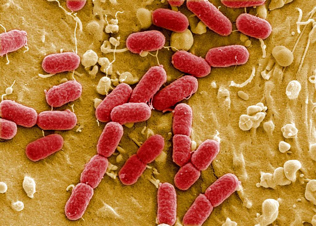 La bactérie E. coli a tué cinq personnes âgées et une fillette de 4 ans.