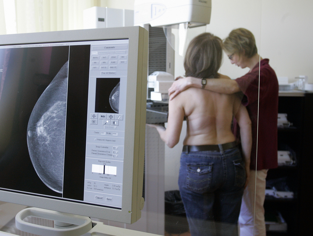 Les taux de mortalité par cancer du sein baisseront de 9% dans l'ensemble de l'UE par rapport à 2014.